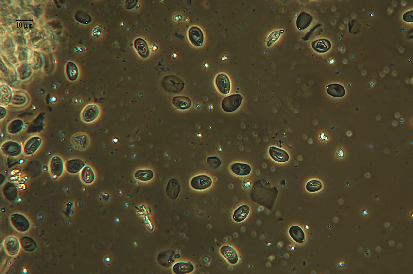 Amyloathelia amylacea (Bourdot & Galzin) Hjortstam & Ryvarde